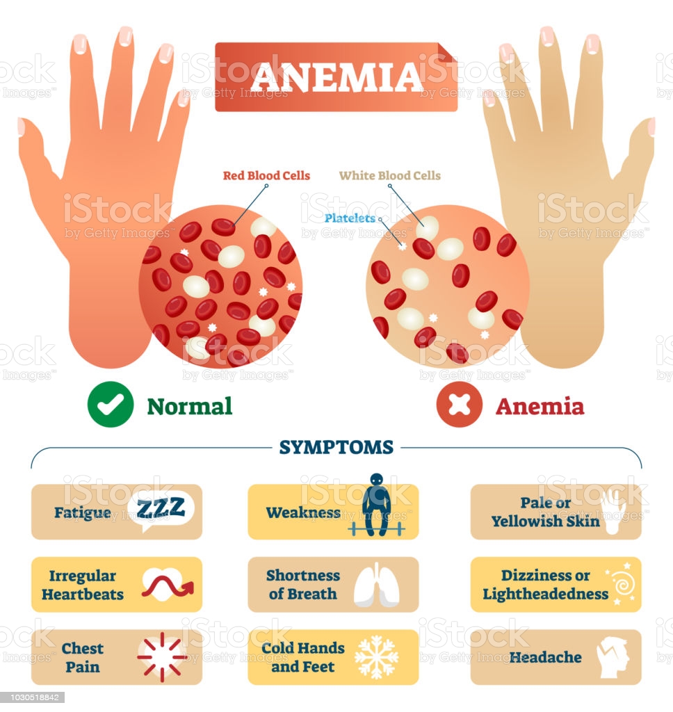 healthy-blood-iron-levels-could-lead-to-a-longer-life